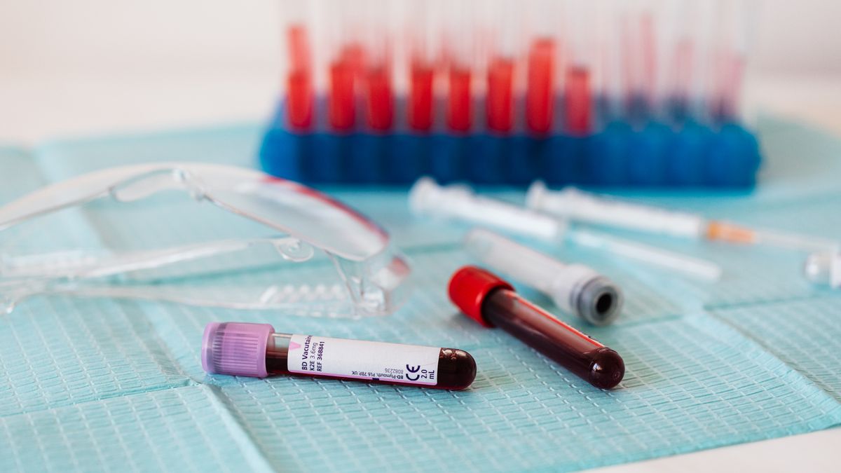 The bronchiectasis biobank and airway microbiome