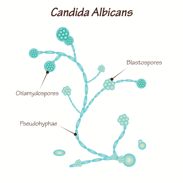 Characterising Candida albicans in chronic airway disease